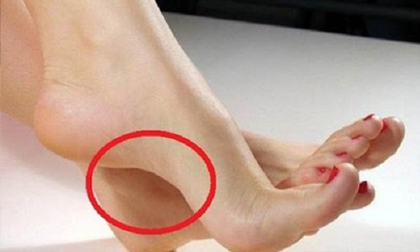 Soi tướng bàn chân 'thiên kim', một bước đi một dặm giàu, viên mãn cả tình lẫn tiền