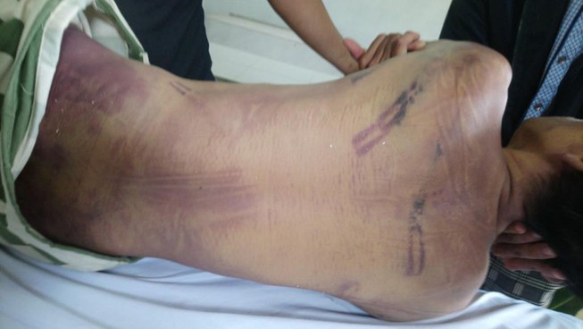 Khoi to bi can vu pham nhan chet trong nha tam giu hinh anh 1 tu_vong_trong_trai_tam_giam_chau_ducthumb_atva.jpg