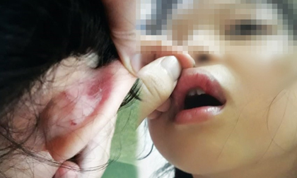 Hà Nội: Phụ huynh tố giáo viên bạo hành học sinh, hiệu trưởng khẳng định không