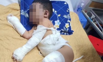 Bình Dương: 1 gia đình bị ném bom xăng, 2 bé trai bỏng nặng