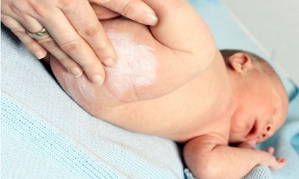 Chuyên gia cảnh báo nguy hại khi sử dụng phấn rôm cho trẻ sơ sinh