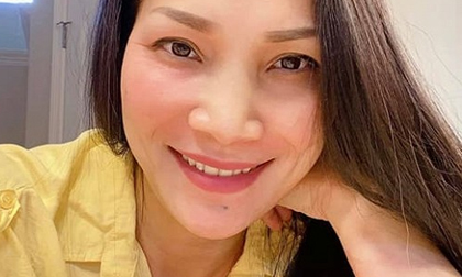 Bất ngờ với hình ảnh phục hồi sau sự cố bỏng của Hồng Ngọc, đến Trấn Thành cũng phải thốt lên 'kỳ diệu'