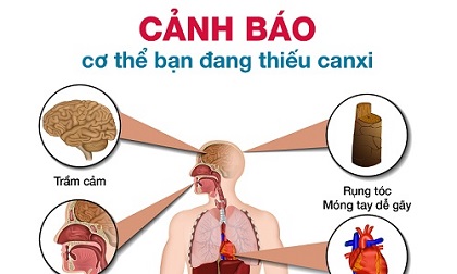 Dấu hiệu cảnh báo cơ thể đang thiếu canxi trầm trọng, cần bổ sung ngay
