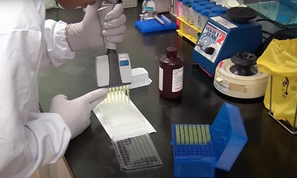 Phát hiện 5 kháng thể chống lại virus gây Covid-19