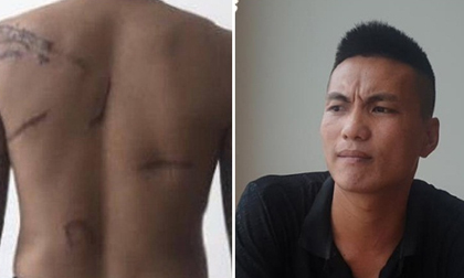Khởi tố vụ án đàn em Đường 'Nhuệ' chém nam thanh niên sau 8 năm 'chìm xuồng'