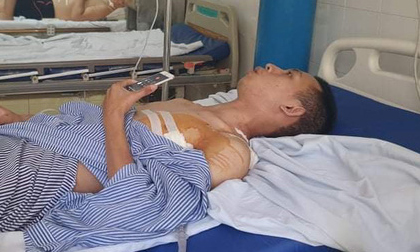 Nam sinh mới ra trường kể giây phút tông xe vào kẻ cướp tiệm vàng, bị đâm trọng thương