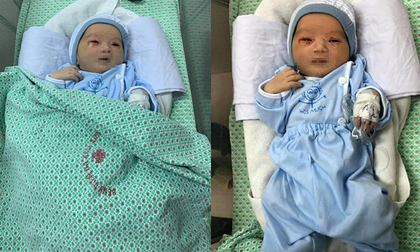 Nhìn lại 20 ngày kiên cường chiến đấu với tử thần của bé trai bị mẹ bỏ rơi dưới hố ga: Ngủ ngon con nhé, mọi đau đớn đã qua rồi!