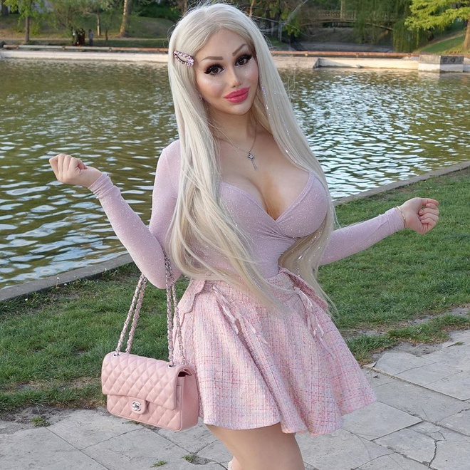 Đời sống - 9X trải qua 10 lần phẫu thuật thẩm mỹ để giống búp bê Barbie (Hình 5).