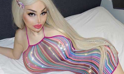 9X trải qua 10 lần phẫu thuật thẩm mỹ để giống búp bê Barbie