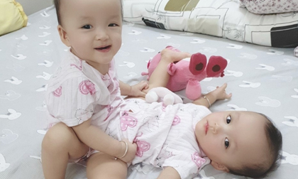 Hành trình sống kỳ diệu của cặp song sinh bị dính liền nhau ở vùng bụng