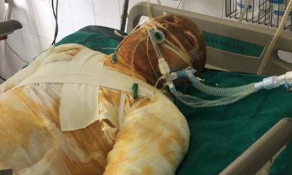 Kẻ tưới xăng “thiêu sống” đồng nghiệp cũ bị khởi tố về tội “Giết người”
