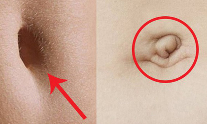 Muốn biết tương lai làm quan to hay thường dân vạn kiếp chỉ cần nhìn vào tướng rốn 3 giây là hiểu