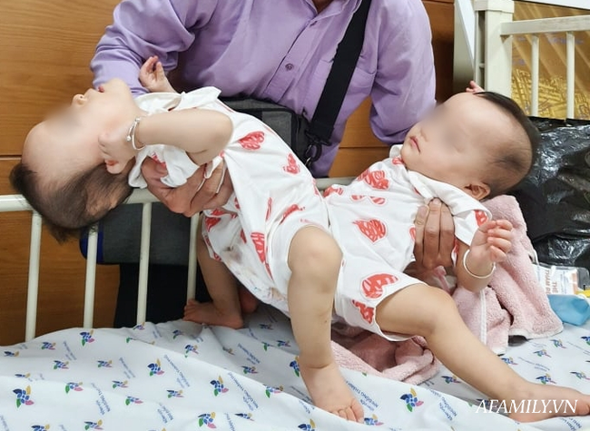 Bác sĩ ekip chỉnh hình trong ca tách song sinh Trúc Nhi - Diệu Nhi tiết lộ khoảnh khắc cuối cùng: Vừa bó bột xong là… muốn gục