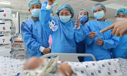 Hai bé song sinh dính liền sau phẫu thuật: Trúc Nhi vẫn phải thở máy