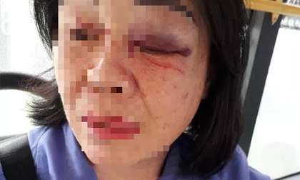 Công an truy tìm kẻ đánh nữ tiếp viên xe buýt 65 bầm mắt