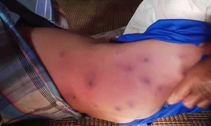 Bé trai 6 tuổi tử vong sau khi bị hàng trăm con ong bắp cày tấn công trong khi tỉa cây cùng bà ngoại