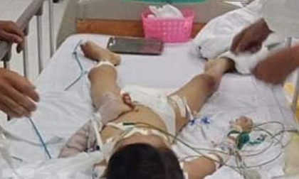 Bé 7 tuổi tử vong sau khi tháo nẹp tay là do ngộ độc thuốc gây tê