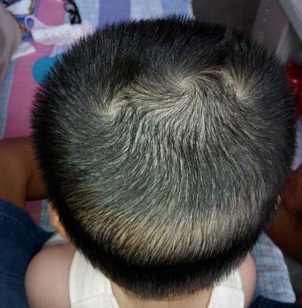 5-kieu-xoay-toc-noi-len-van-menh-cuc-chuan-cua-be-Hinh-6