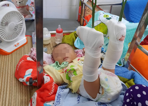 Người cha say rượu đánh con trai ruột 4 tháng tuổi gãy cả 2 chân lãnh 78 tháng tù - 1 Người cha say rượu đánh con trai ruột 4 tháng tuổi gãy cả 2 chân lãnh 78 tháng tù - 1