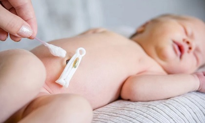 Những dấu hiệu ở rốn cảnh báo trẻ sơ sinh gặp nguy hiểm