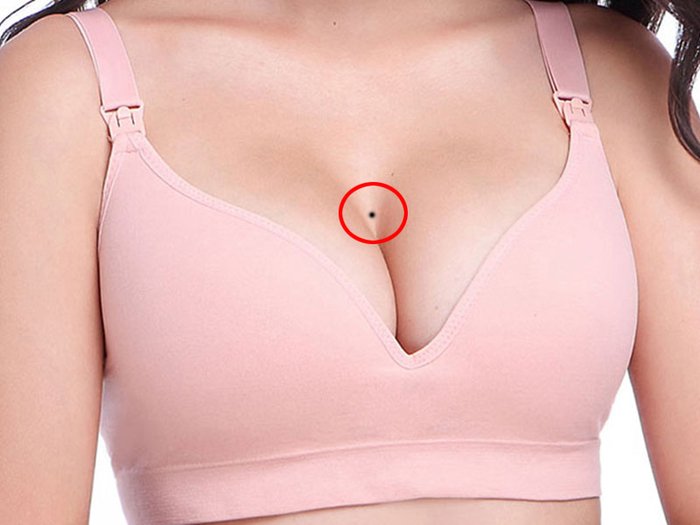 Nốt ruồi vùng ngực hút lộc