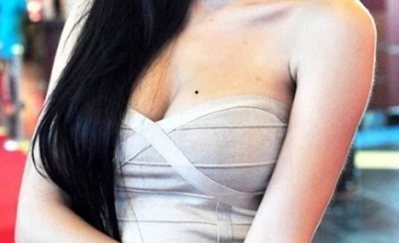 Nốt ruồi hiếm có hút lộc