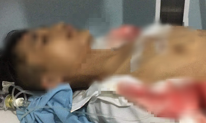 Nam sinh bị học sinh lớp trên đâm ngay tại cổng trường