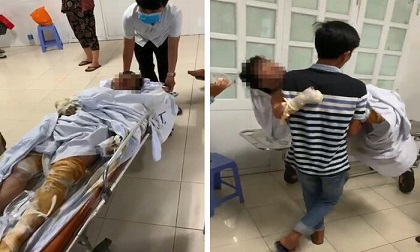 Khởi tố, bắt tạm giam nghi phạm phóng hỏa đốt nhà ở Phú Yên khiến 4 người trong gia đình bị bỏng nặng