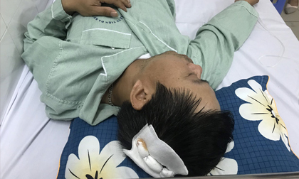 Nhân viên phụ xe bị đánh gục giữa lòng Hà Nội: 'Tôi không ngờ họ lại đánh mình dã man đến thế'