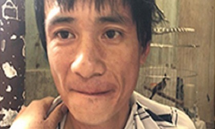 Bắt tên cướp kéo lê cô gái trên đường để lấy xe ở Đồng Nai