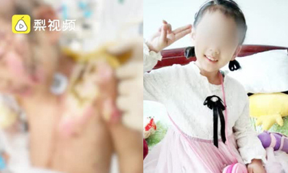 'Địa ngục trần gian': Bé gái 6 tuổi bị mẹ ruột cùng bạn trai bạo hành dã man 3 tháng trời, bố đẻ gặp lại cũng không nhận ra con mình