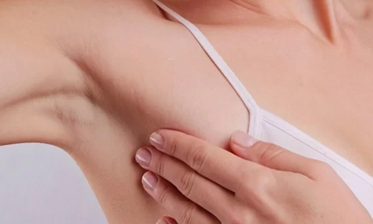 Có 1 trong 5 dấu hiệu này: Bạn cần đi kiểm tra vòng 1 ngay, kẻo ung thư vú gõ cửa