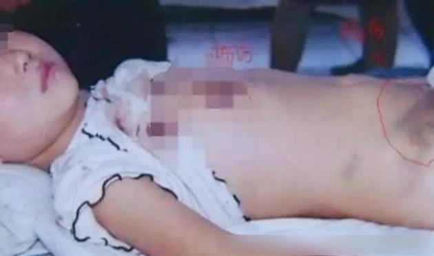 Vụ mẹ bạo hành con chấn động Trung Quốc: Cuộc đời ngắn ngủi đầy đòn roi của đứa trẻ kết thúc trong vai diễn hoàn hảo của mẹ - 3