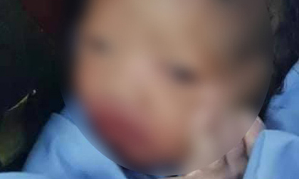Thanh Hóa: Cứu sống bé trai sơ sinh bị bỏ rơi trong tình trạng nguy kịch