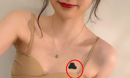 Phụ nữ có vết bớt ở 4 vị trí này là dấu hiệu có số thiên kim, cả đời hưởng phúc