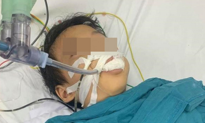 Bé trai 6 tuổi ăn nhầm thuốc diệt chuột hình viên kẹo