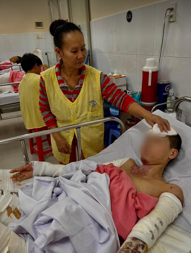 Kinh hoàng nghi án vợ bị chồng tưới xăng đốt làm bỏng nặng đến 58% sau cơn cuồng ghen Kinh hoàng nghi án vợ bị chồng tưới xăng đốt làm bỏng nặng đến 58% sau cơn cuồng ghen