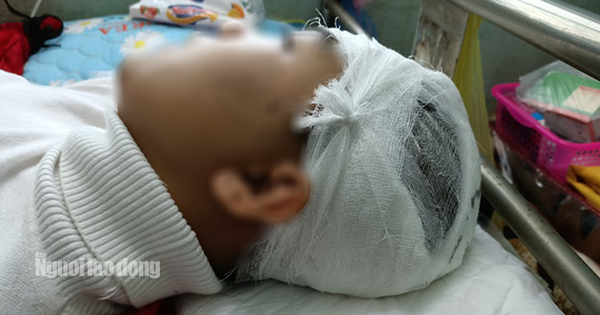 Nam sinh lớp 11 bị bạn cùng trường dùng gậy sắt đánh vỡ sọ não? Nam sinh lớp 11 bị bạn cùng trường dùng gậy sắt đánh vỡ sọ não?