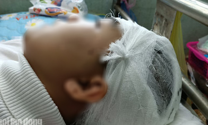 Vụ nam sinh lớp 11 bị đánh vỡ sọ não: Công an huyện nói gì?