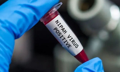 Virus Nipah gây phù não được cảnh báo có thể là đại dịch tiếp theo: Chưa có vắc-xin phòng bệnh và có thể ủ bệnh hơn 1 tháng mà không biết