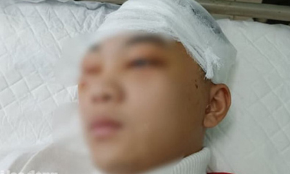 Khởi tố, bắt giam nam sinh lớp 11 đánh bạn học vỡ sọ não