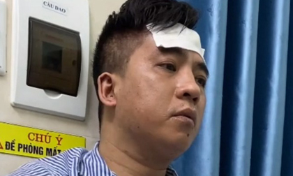 Sát hại người tình trong nhà nghỉ, lấy lắc vàng bỏ trốn