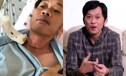 NS Hoài Linh lộ việc bị K tuyến giáp giữa lùm xùm vụ 14 tỷ đồng kêu gọi tiền từ thiện