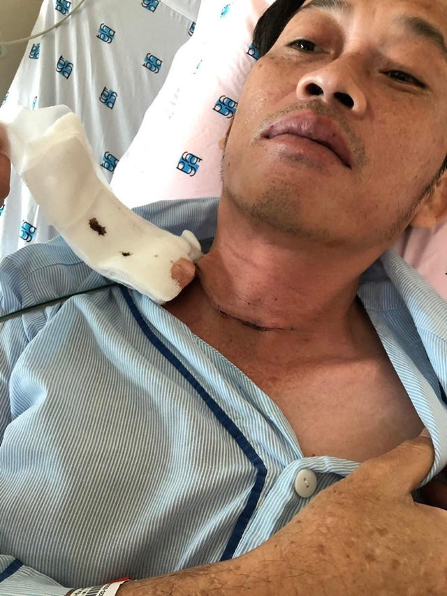 Căn bệnh ung thư mà Nghệ sĩ Hoài Linh mắc có nguy hiểm không? - Ảnh 1.