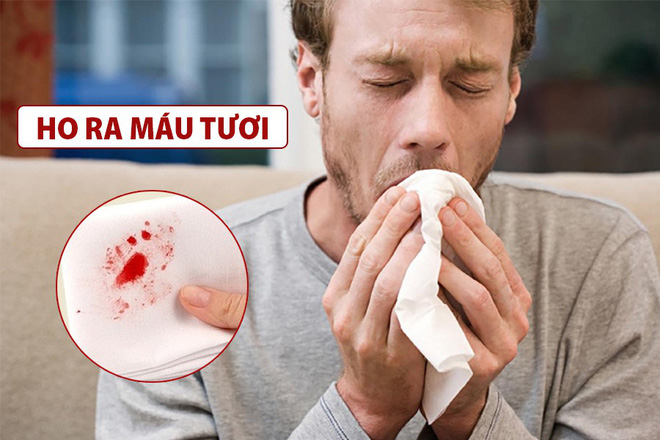 Thêm 1 triệu chứng Covid-19 mới: Bệnh nhân ho ra máu; Thế giới ghi nhận gần 38 triệu người chết - Ảnh 1.