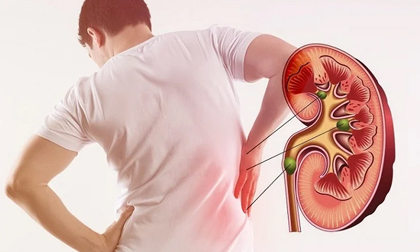 5 dấu hiệu cảnh báo thận đang ‘xuống sức’, đi khám ngay kẻo suy thận có ngày
