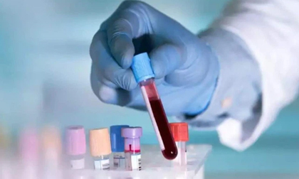 'Sốt ruột' về nguồn gốc Covid-19: WHO quyết định phân tích lại mẫu máu lưu trữ từ 2019 do Ý cung cấp
