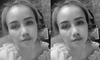 Công an vào cuộc vụ nữ diễn viên Hoàng Yến bị chồng cũ đấm chảy máu, cầm dao đe doạ