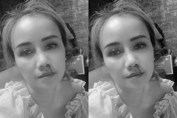 Hoàng Yến băng bó mặt, sợ hãi: Tôi bật dậy thì thấy anh ta cầm con dao dí vào mặt mình - Ảnh 3.