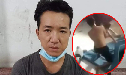 Thông tin mới nhất vụ bé trai bị đánh dã man ở Bình Dương: Kẻ ra tay là cha dượng, mới dọn về ở cùng vợ hờ